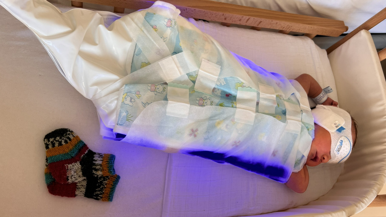 Der BiliCocoon Spezialschlafsack ermöglicht eine schonende Phototherapie bei Neugeborenengelbsucht – ohne Trennung von den Eltern.