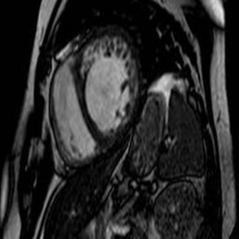 Kardiologie - Röntgen-Thorax, Thorax-CT, Kardio-CT, Kardio-MR