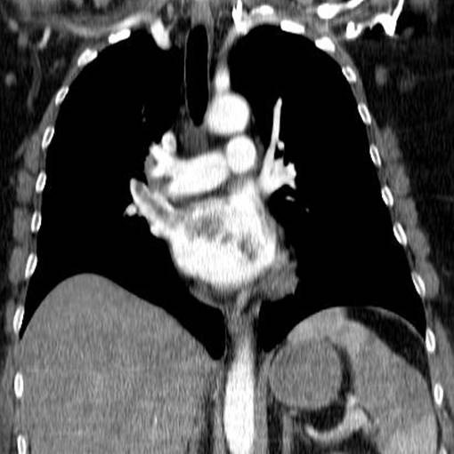 Kardiologie - Röntgen-Thorax, Thorax-CT, Kardio-CT, Kardio-MR